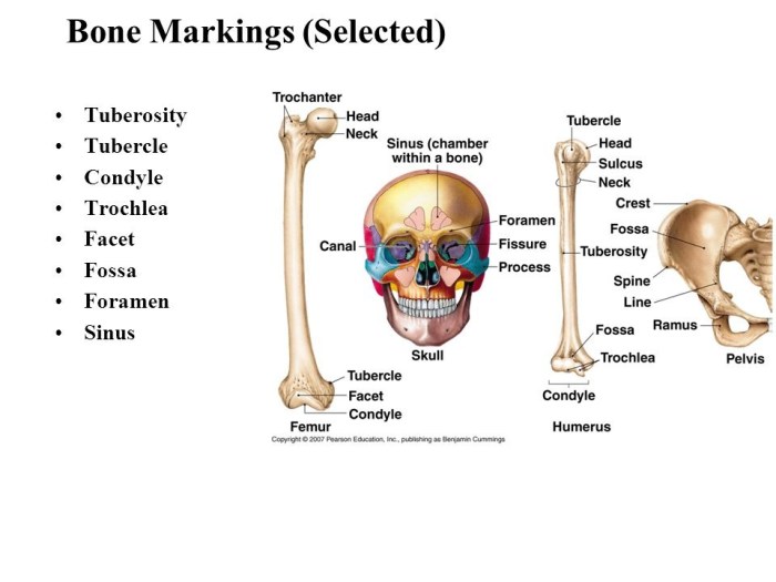 Bones and bone markings quiz